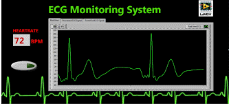 Strain Measurement