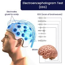 Strain Measurement