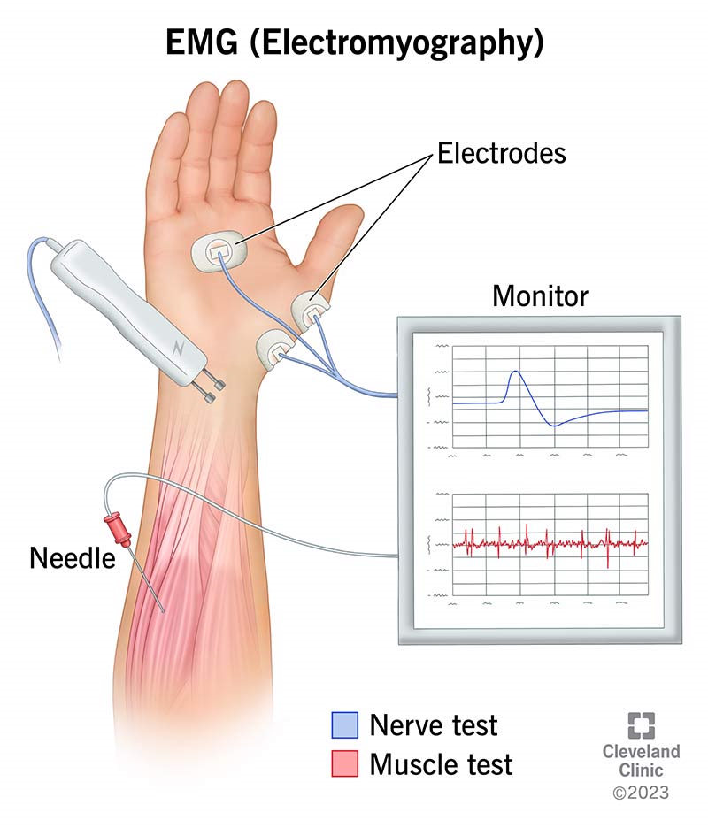 Strain Measurement